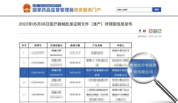 “胸肺三件套”黄金组合 全面助力胸部多种疾病一查多筛