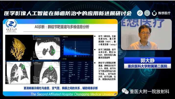 助力肺癌精准诊疗,重医大附一院举办医学影像人工智能应用新进展研讨会 新闻资讯 第11张 助力肺癌精准诊疗,重医大附一院举办医学影像人工智能应用新进展研讨会 新闻资讯 第11张