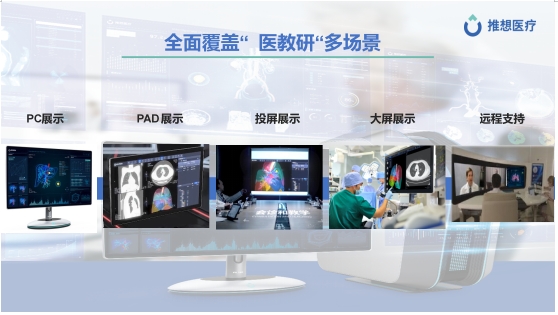 CHIMA | AI助力智慧医院建设,推想交出“全院级优秀答卷” 新闻资讯 第3张 CHIMA | AI助力智慧医院建设,推想交出“全院级优秀答卷” 新闻资讯 第3张